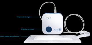 BX/5 AVELLE NPWT SYSTEM (12X21)CM (4X13)CM INNER PAD W/ HYDROFIBER CORE & SILICONE ADHESIVE BORDER