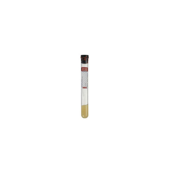 BX/100 TUBE VACUTAINER SST+16 X 125MM 10ML RED/GRY